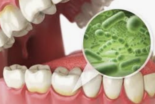 Does Prodentim Heal Cavities